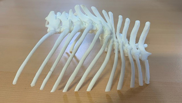 3D model of Franks spine