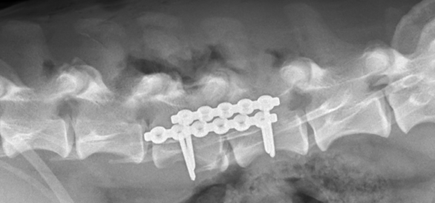 internal image after surgery